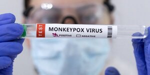 France-plus de 2.600 cas de variole du singe, plus de 30.000 vaccines, selon francois braun