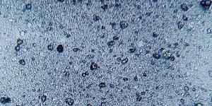microplastiques, polyéthylène, billes, dentifrice, abrasif, plaque dentaire, gencive, colorant,